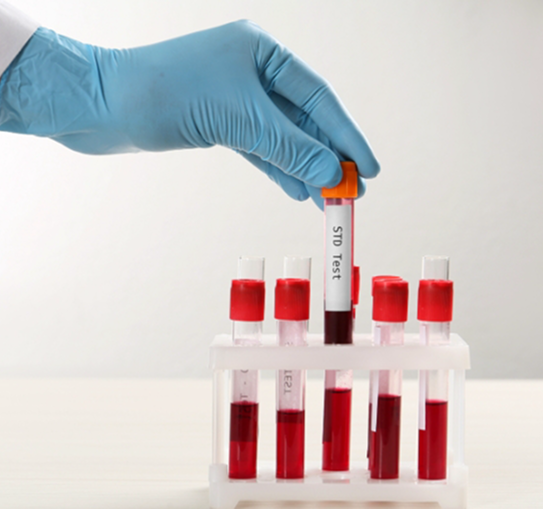 Sti Testing Panel Infectious Disease Testing Services | GreenArray Labs India